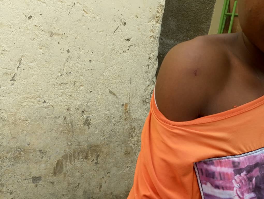 Rubavu: Irondo ntiririvangura n'ibisambo