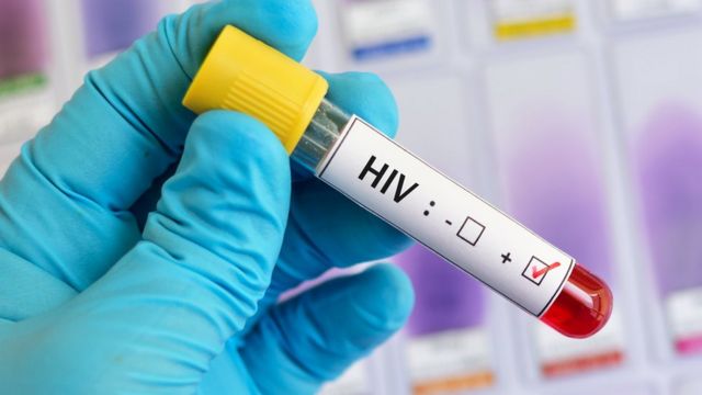 Virusi ya Sida mu baryamana bahuje ibitsina iratanga impuruza