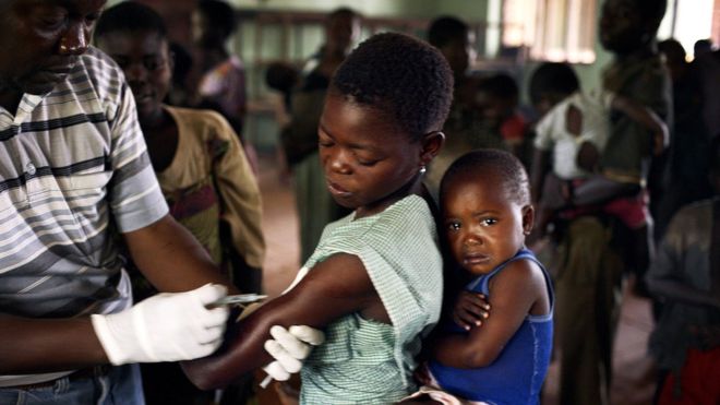 CONGO: Umuryango w'abibumbye uratangaza ko indwara y'iseru imaze guhitana abana barenga 100 kuva uyu mwaka watangira