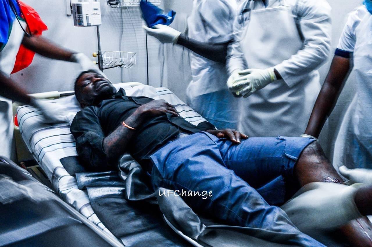 Uganda: Bobi Wine ati 'narashwe', Polisi iti ni 'ugutsikira'