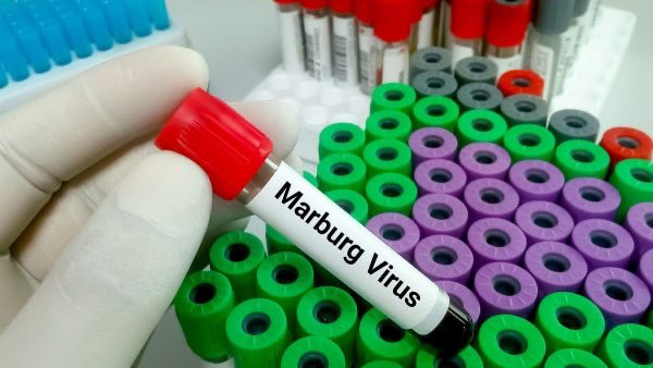 Marburg mu Rwanda: Abanduye bageze kuri 26