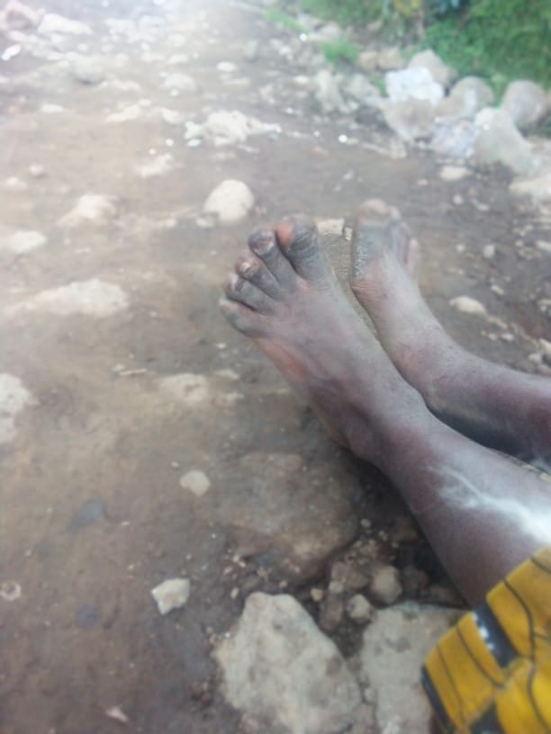 Musanze: Abaturage baratabariza abana b'abasigajwe inyuma n'amateka bagiye kicwa n'amavunja