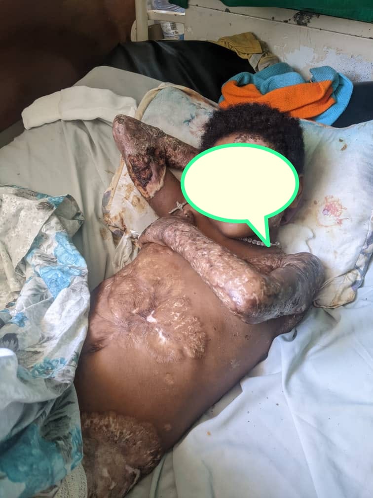 Burera: Umwana umaze imyaka 11 arembeye mu bitaro bya Byumba arasabirwa ubufasha