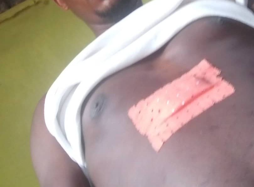 Rubavu: Abamuteye icyuma barakidegembya