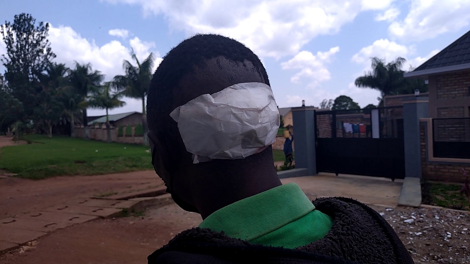 Huye: Umuturage yakomekejwe bikomeye nabo akeka ko ari abanyerondo