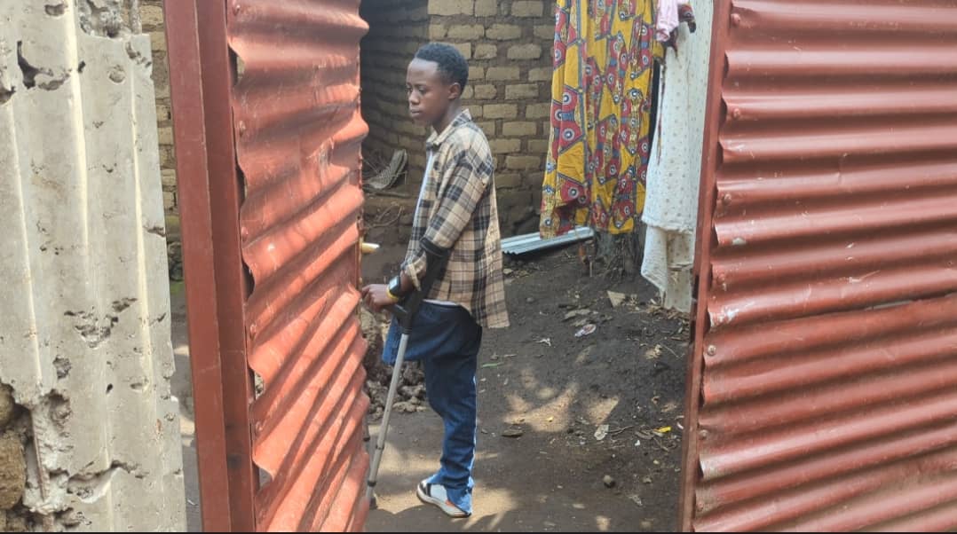 Rubavu: Yagonzwe n'imodoka agacika akaguru, hanyuma agakatirwa gufungwa